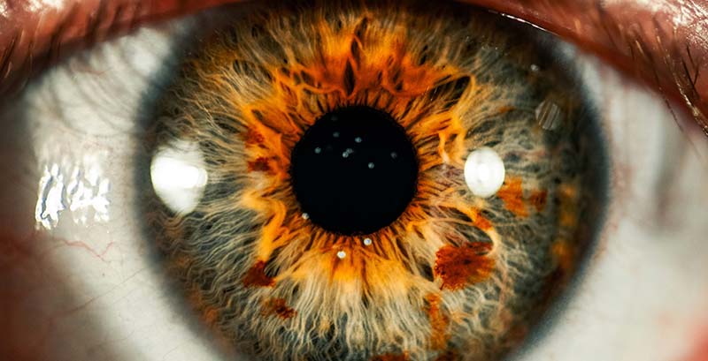 Photo d'un iris pour l'iridologie pratiquée par naturopathe iridologue